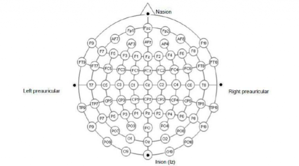 electrode positioning system